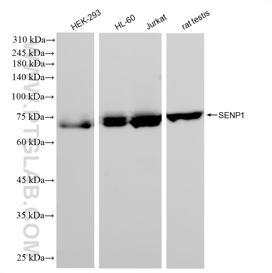 WB analysis using 83594-4-RR