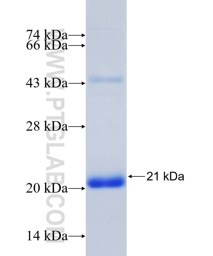 SENP2 fusion protein Ag31098 SDS-PAGE SENP2 fusion protein Ag31098 SDS-PAGE