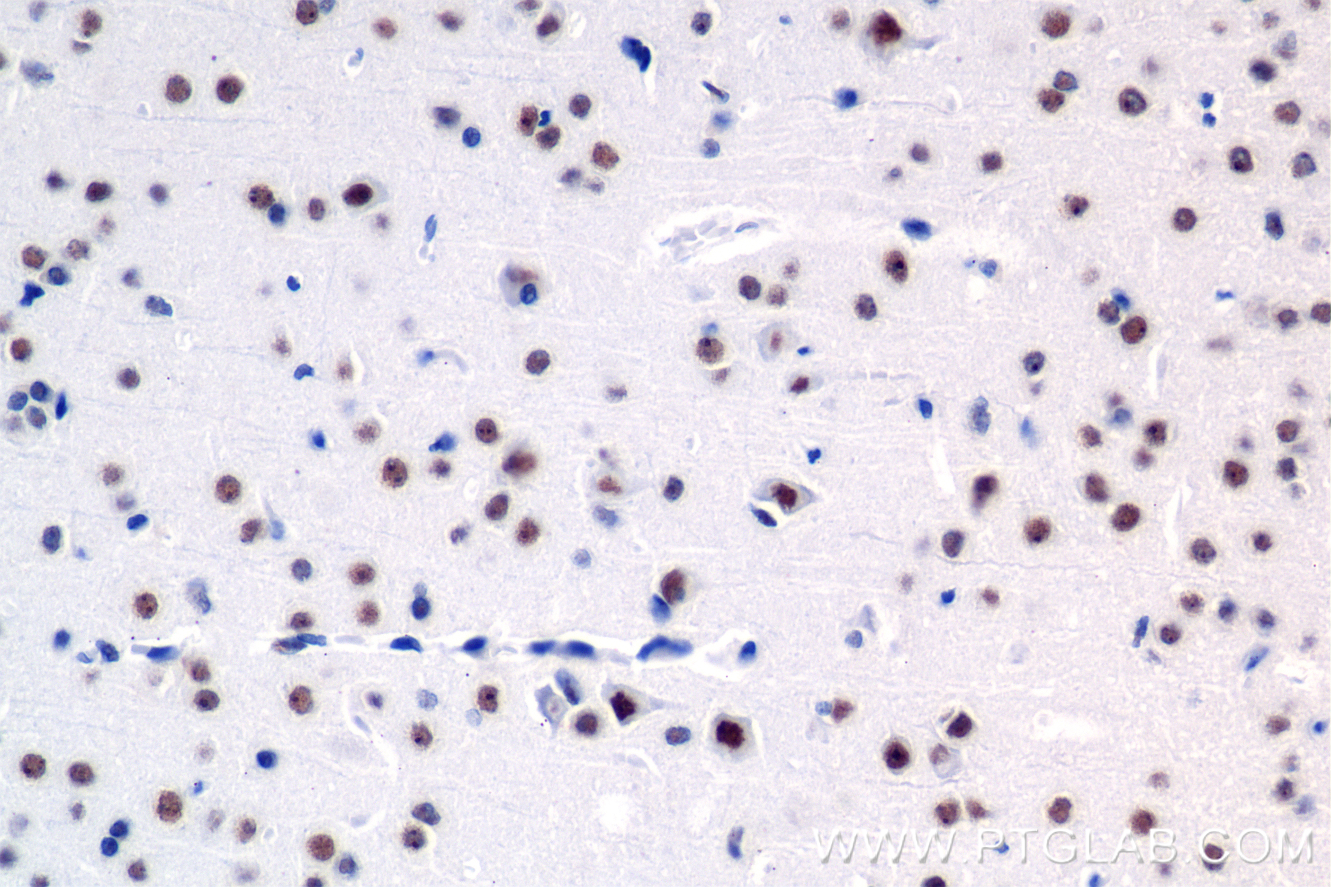 IHC staining of mouse brain using 85837-3-RR (same clone as 85837-3-PBS)
