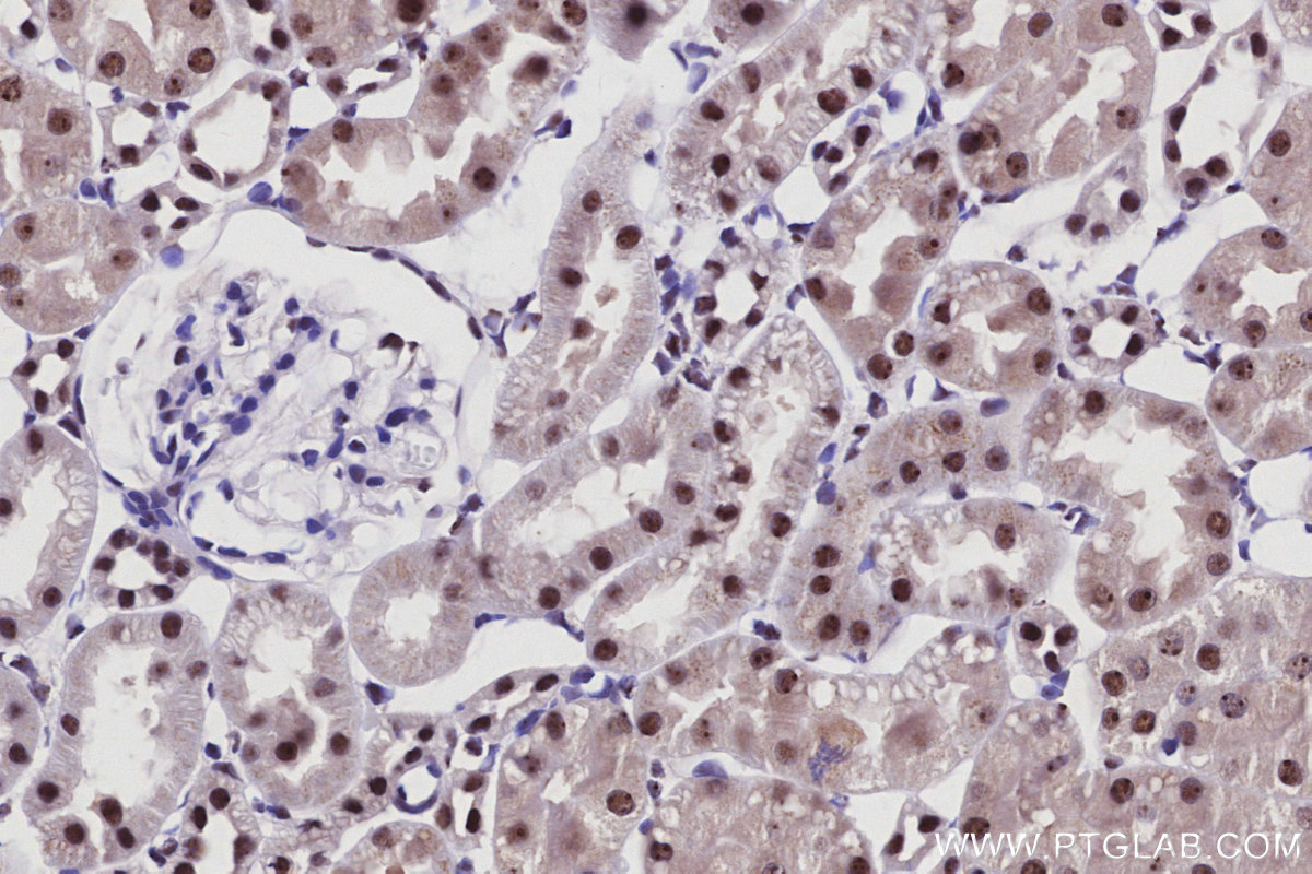 IHC staining of rat kidney using 85837-3-RR IHC staining of rat kidney using 85837-3-RR
