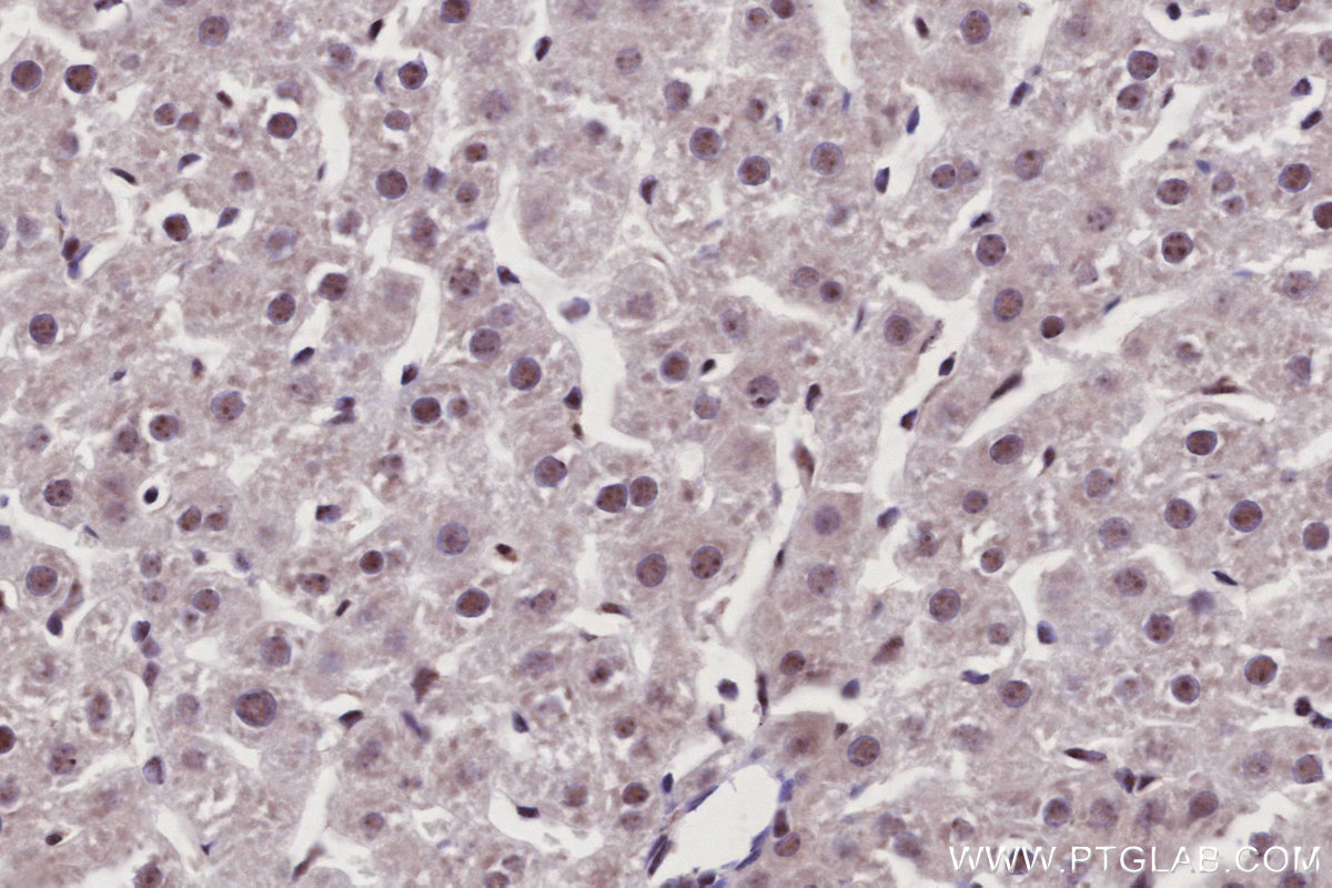 IHC staining of rat liver using 85837-3-RR IHC staining of rat liver using 85837-3-RR