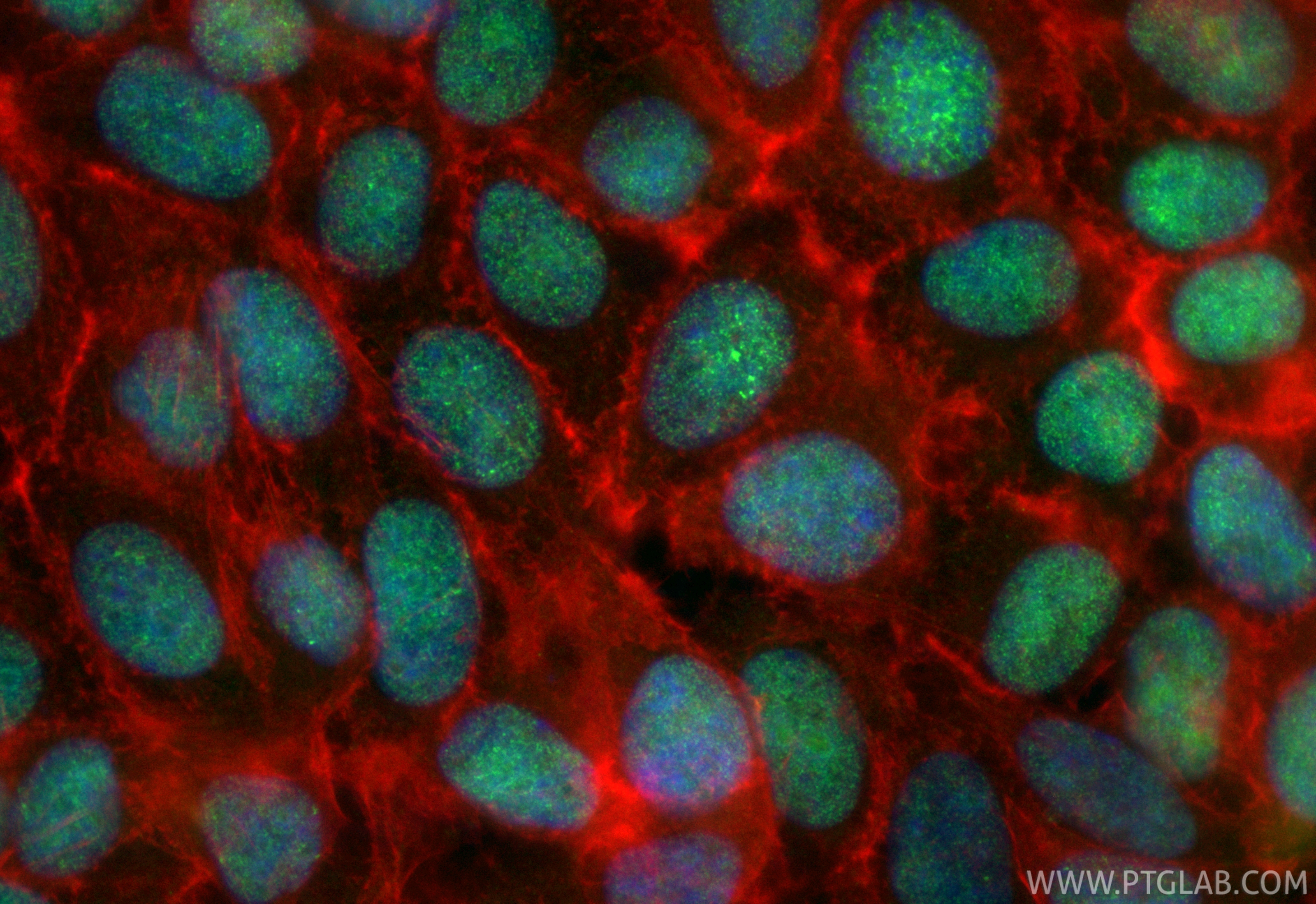 Immunofluorescent analysis of (4% PFA) fixed MCF-7 cells using CoraLite® Plus 488 SENP3 antibody (CL488-85837-3, Clone: 250153A9 ) at dilution of 1:200, CL594-Phalloidin (red). IF Staining of MCF-7 using CL488-85837-3