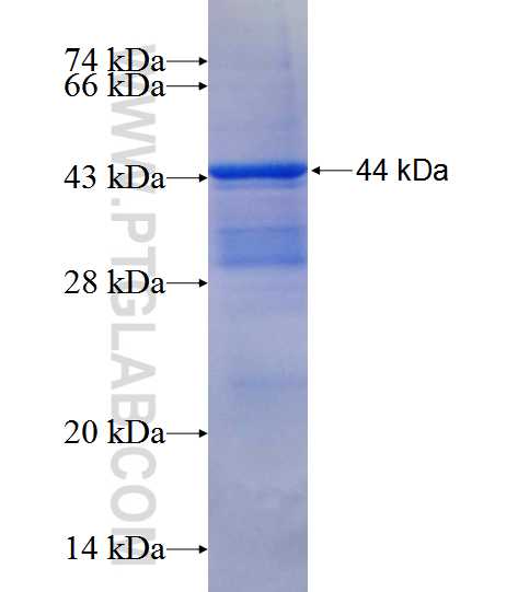 SENP3 fusion protein Ag11930 SDS-PAGE SENP3 fusion protein Ag11930 SDS-PAGE