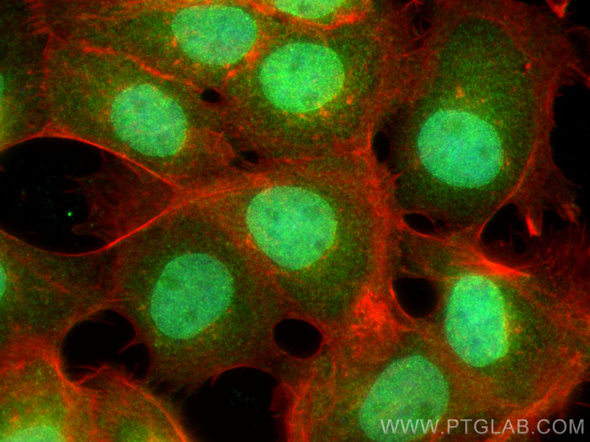 IF Staining of A431 using 13479-1-AP