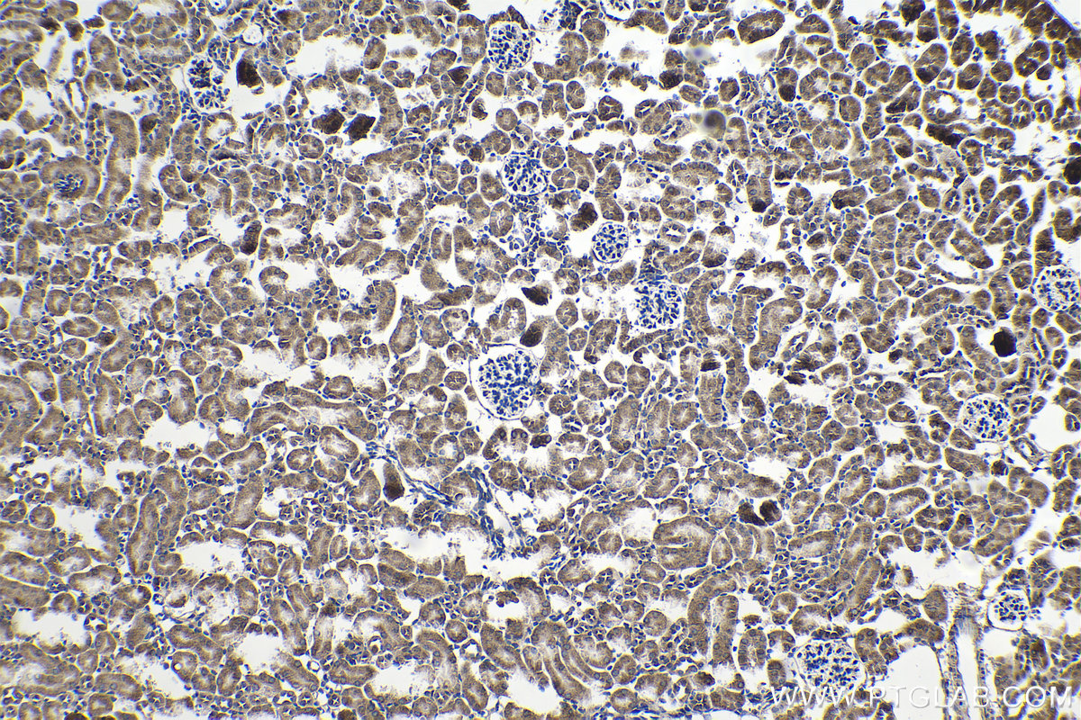 IHC staining of mouse kidney using 13479-1-AP