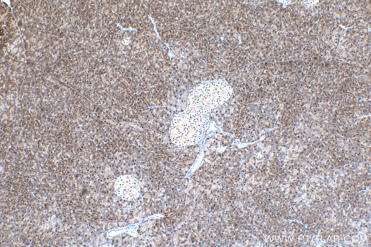 IHC staining of mouse pancreas using 14109-1-AP