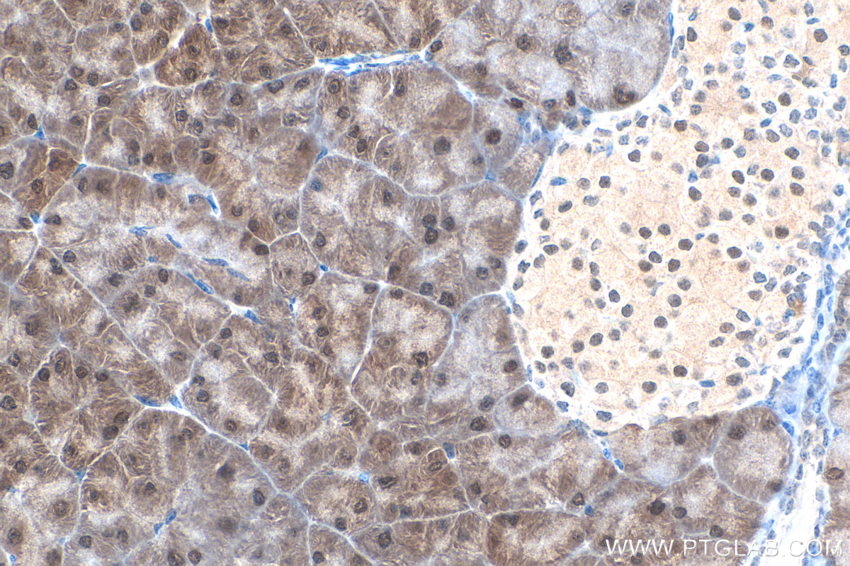 IHC staining of mouse pancreas using 14109-1-AP