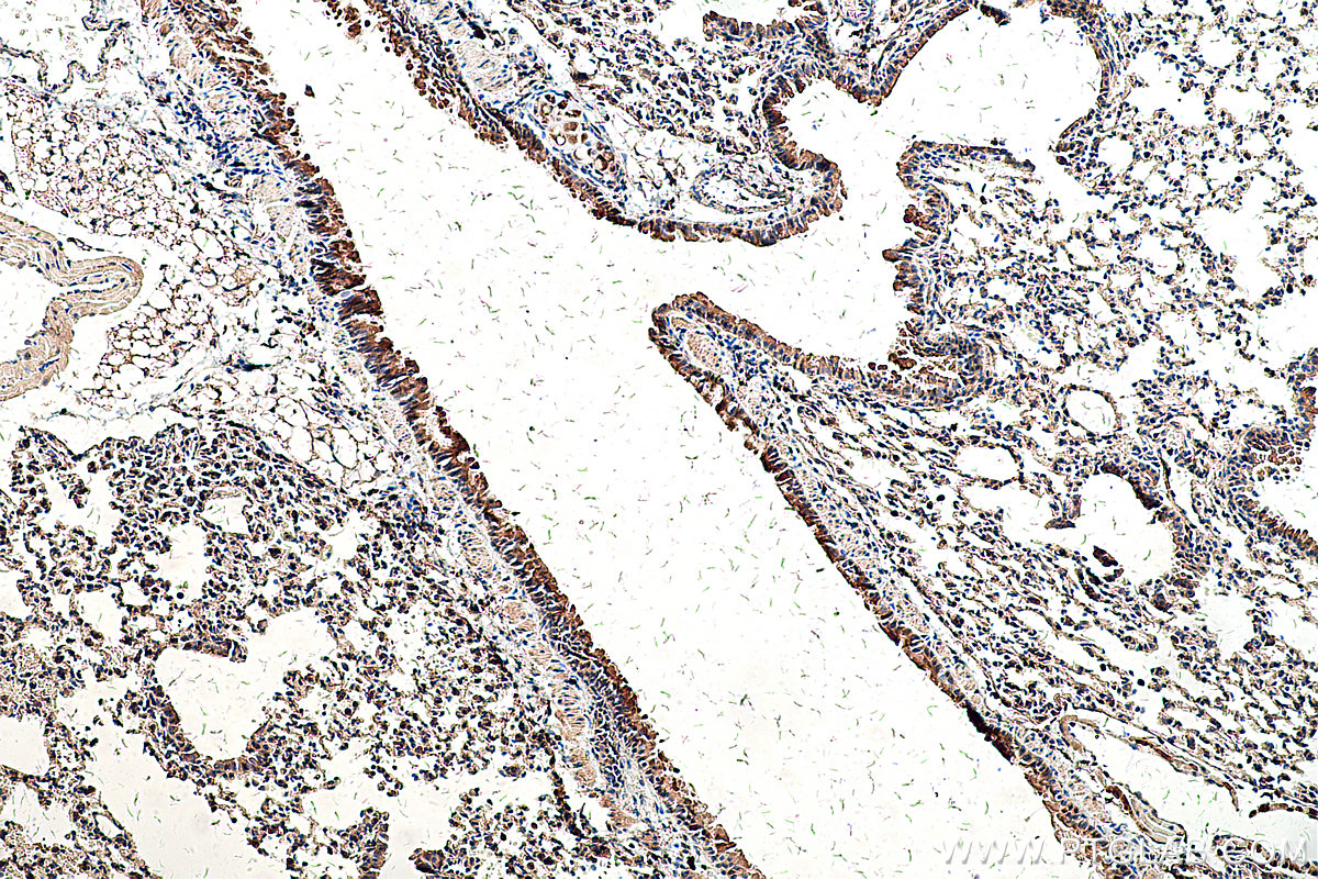 IHC staining of mouse lung using 55333-1-AP