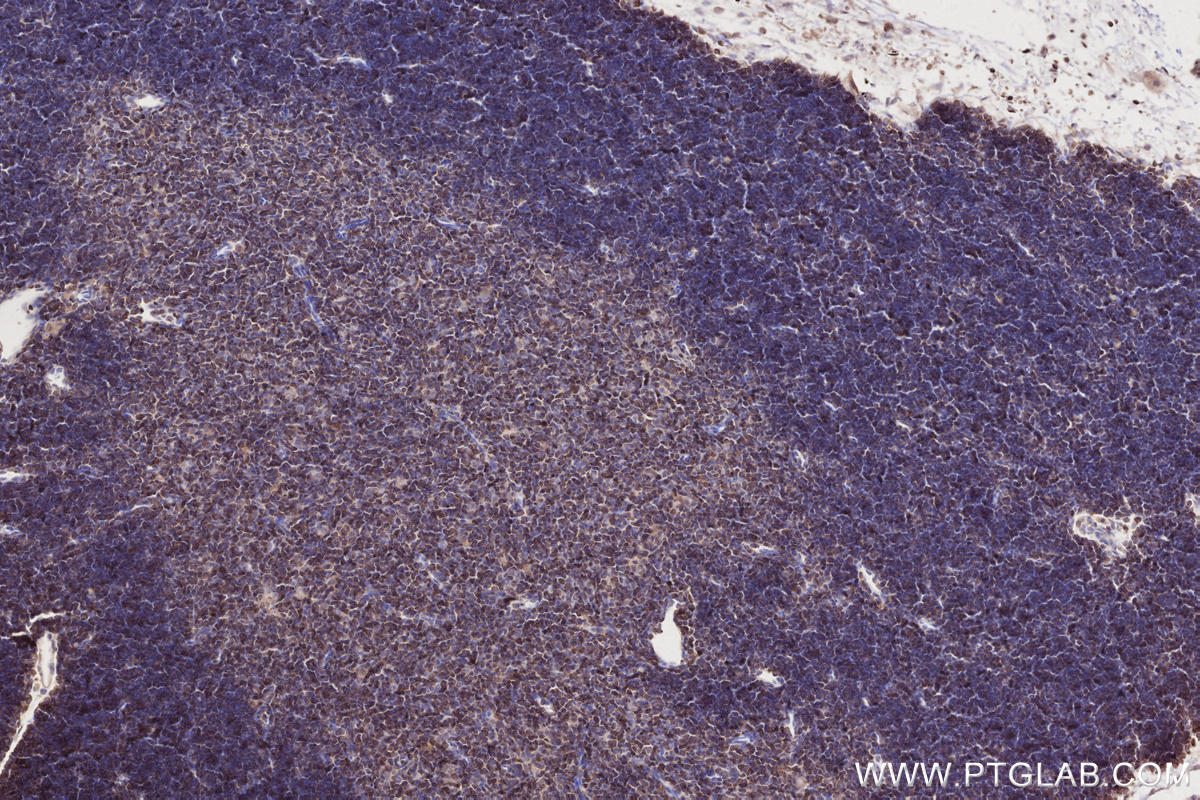 IHC staining of mouse thymus using 11370-1-AP IHC staining of mouse thymus using 11370-1-AP