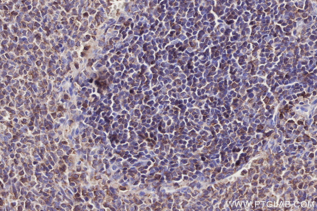 IHC staining of rat spleen using 11370-1-AP IHC staining of rat spleen using 11370-1-AP