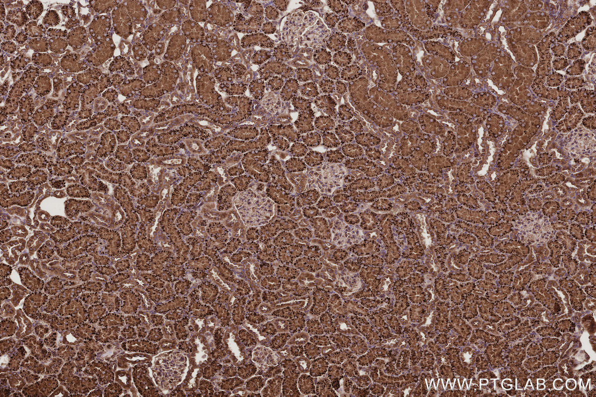 IHC staining of rat kidney using 12420-1-AP IHC staining of rat kidney using 12420-1-AP