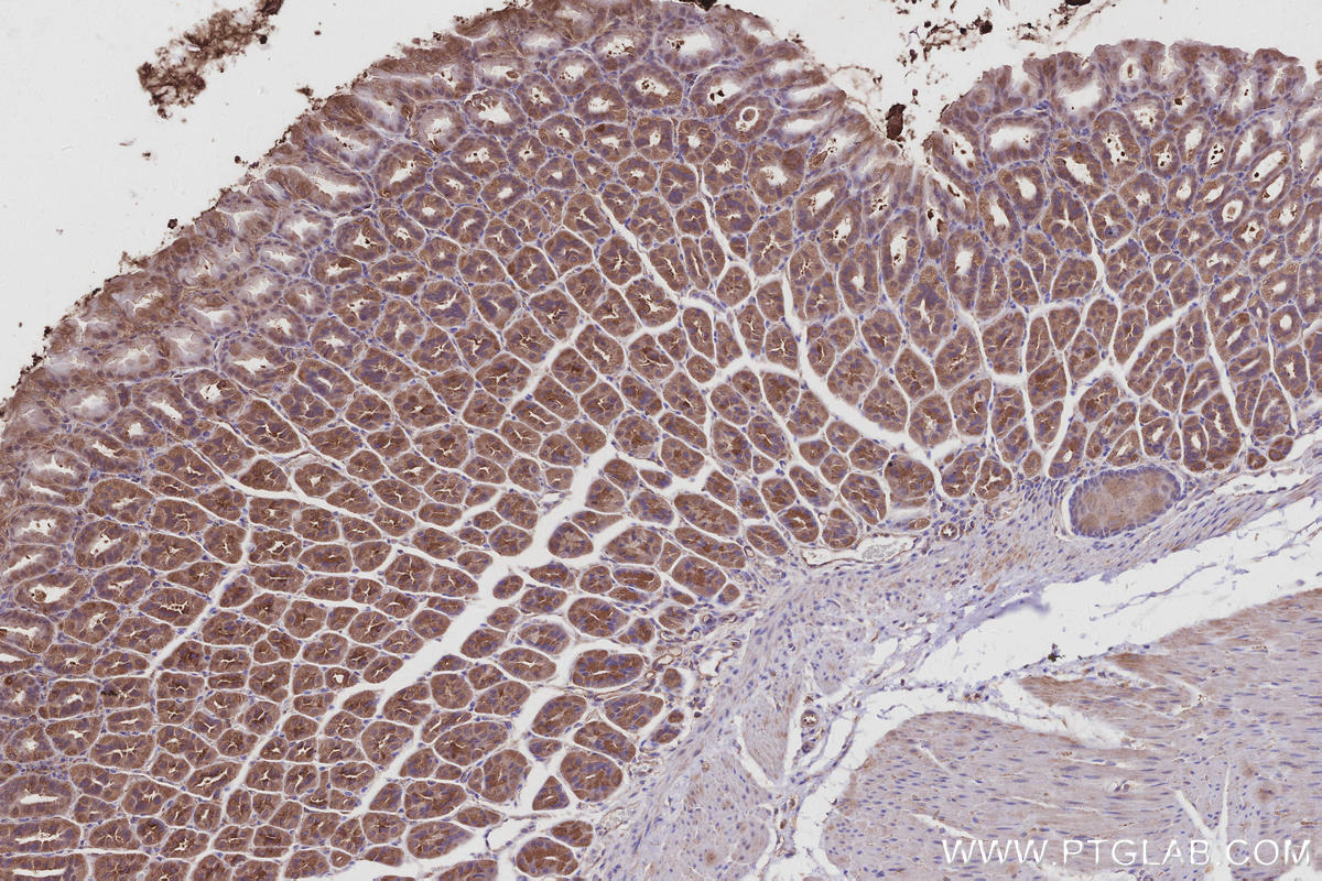 IHC staining of mouse stomach using 14672-1-AP IHC staining of mouse stomach using 14672-1-AP