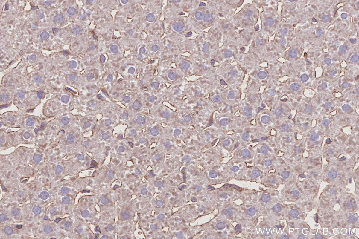 IHC staining of rat liver using 14672-1-AP IHC staining of rat liver using 14672-1-AP