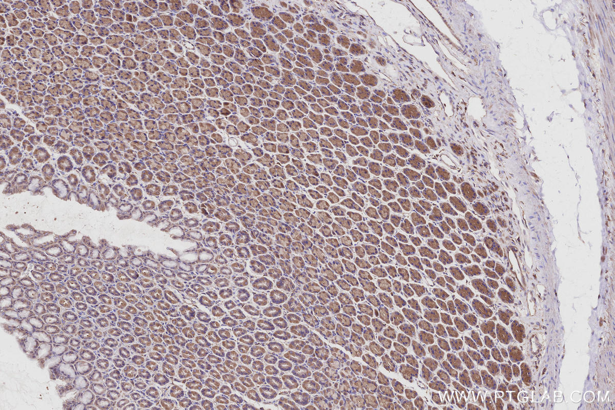 IHC staining of rat stomach using 14672-1-AP IHC staining of rat stomach using 14672-1-AP