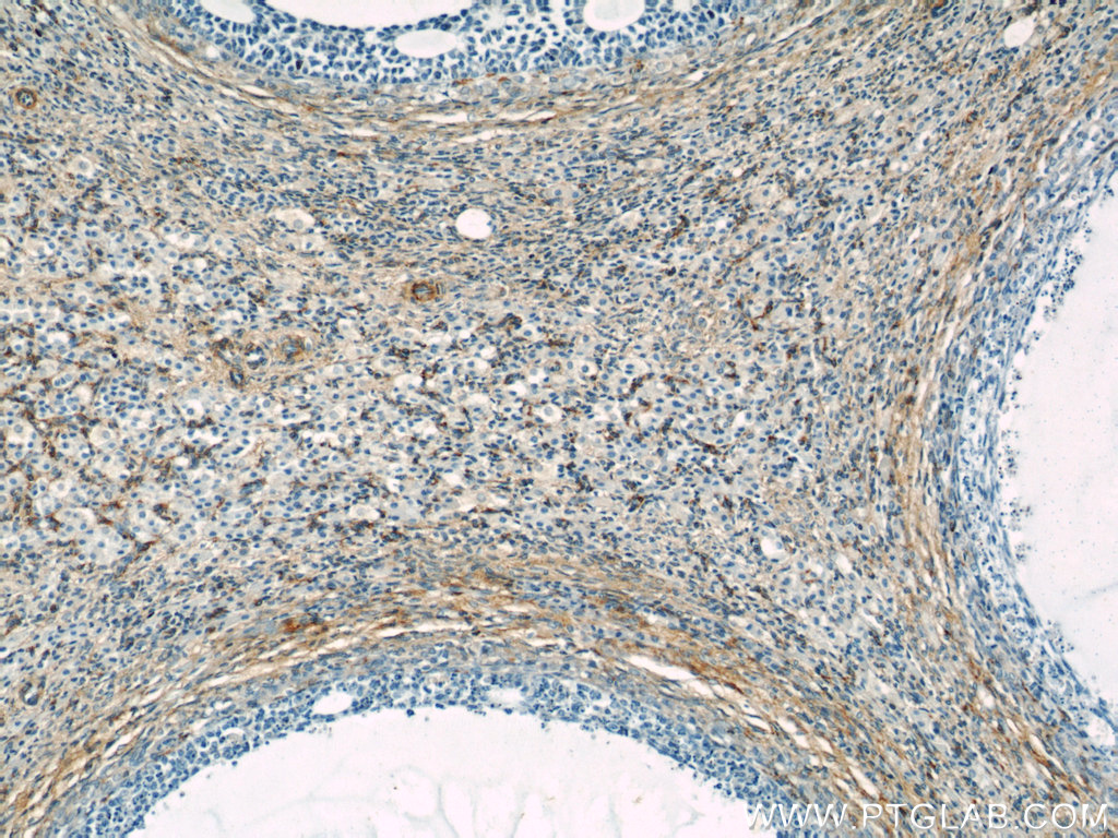 IHC staining of human ovary using 14672-1-AP