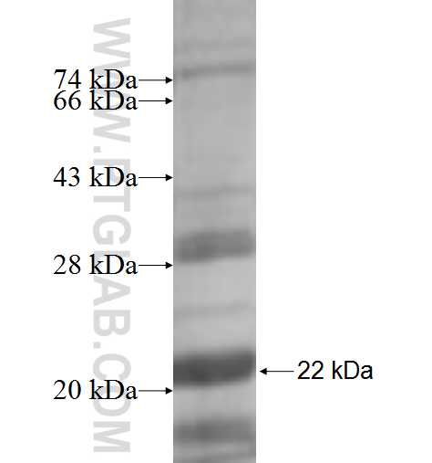 SEPT11 fusion protein Ag6572 SDS-PAGE SEPT11 fusion protein Ag6572 SDS-PAGE