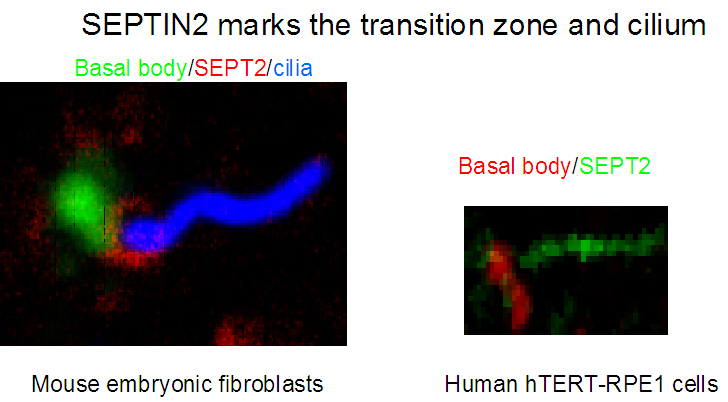 IF Staining of hTERT-RPE1 cells and Mouse embryonic fibroblasts using 11397-1-AP