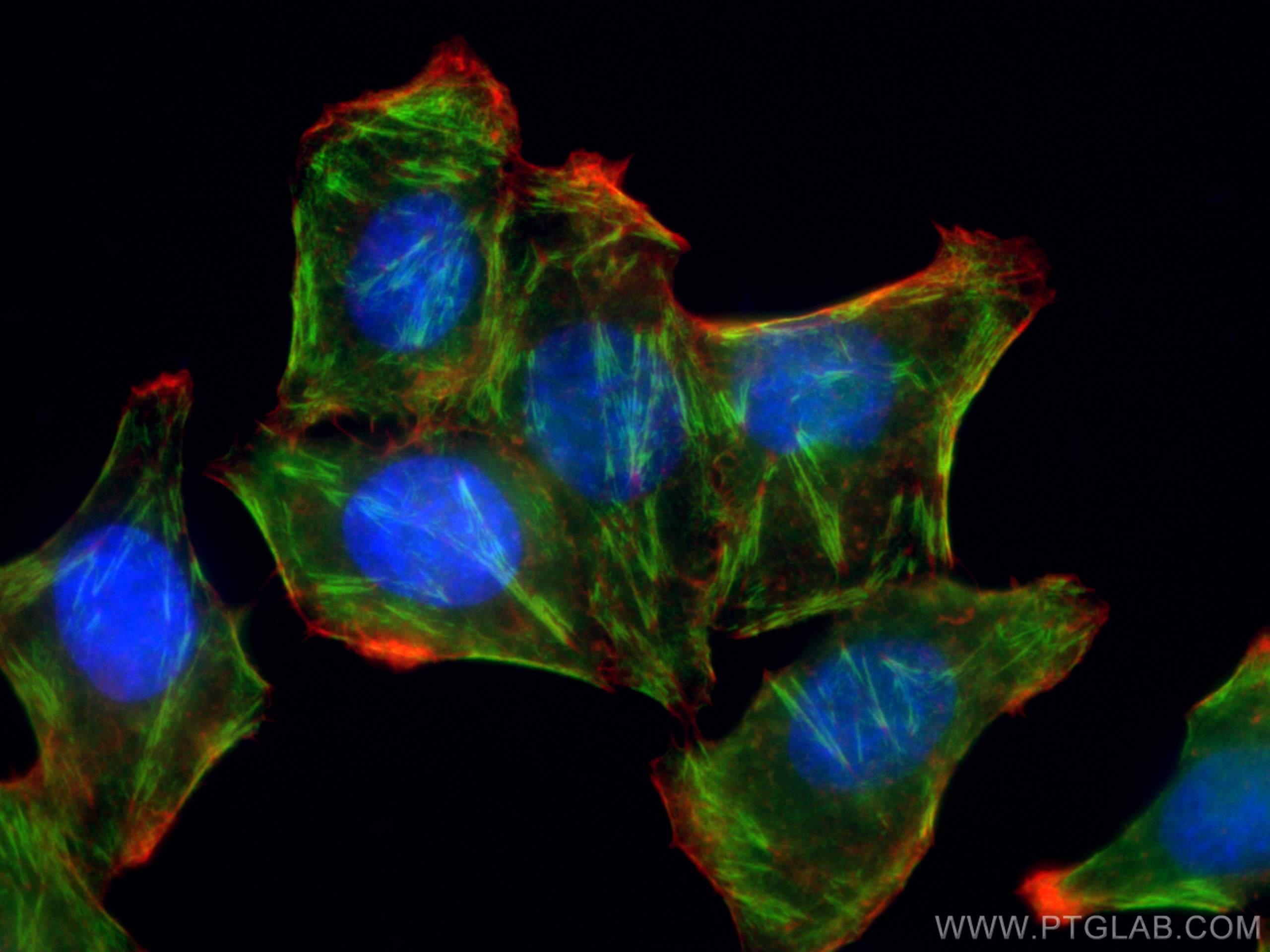 IF Staining of HepG2 using 11397-1-AP