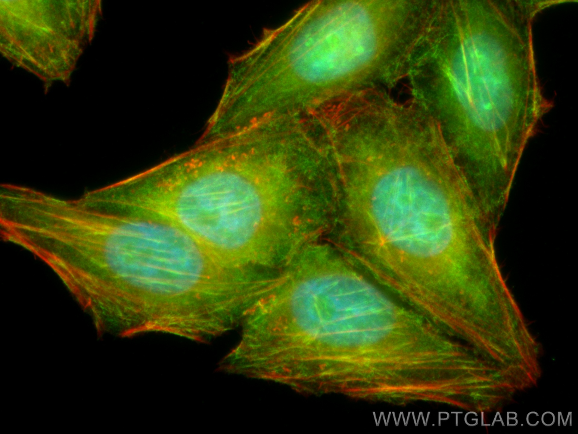 IF Staining of HepG2 using 11397-1-AP