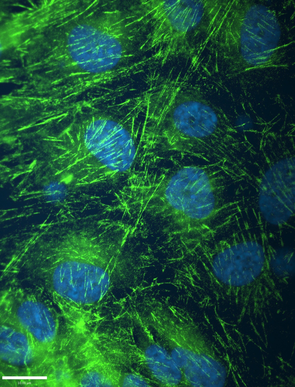 IF Staining of hTERT-RPE cells using 60075-1-Ig