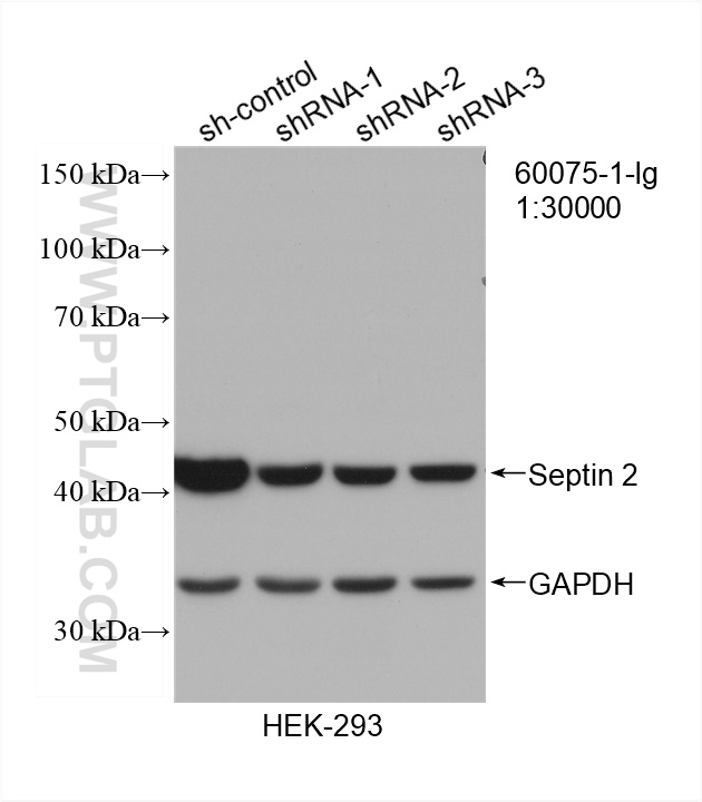 WB analysis of HEK-293 using 60075-1-Ig