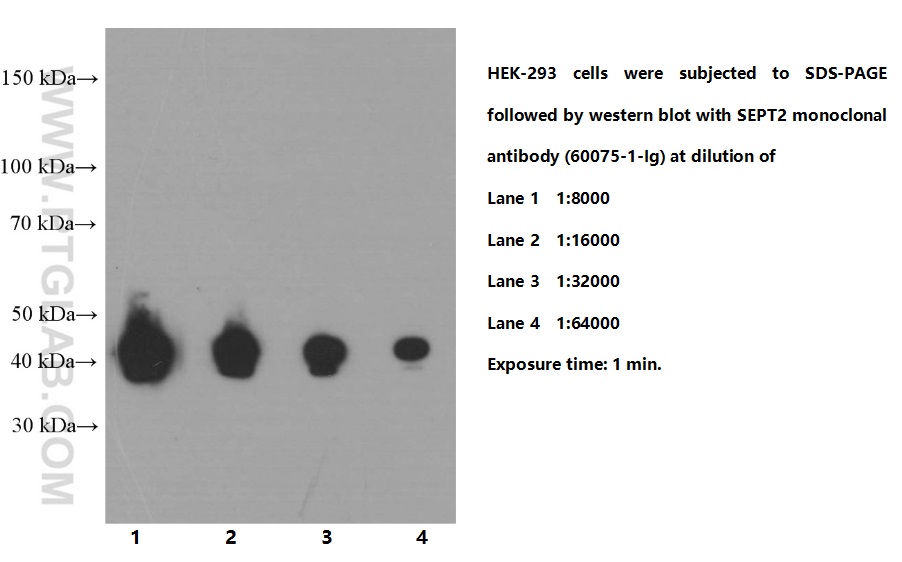 WB analysis of HEK-293 using 60075-1-Ig