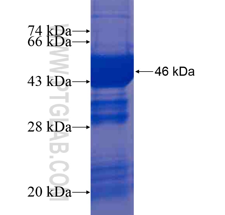 SEPT2 fusion protein Ag16675 SDS-PAGE SEPT2 fusion protein Ag16675 SDS-PAGE