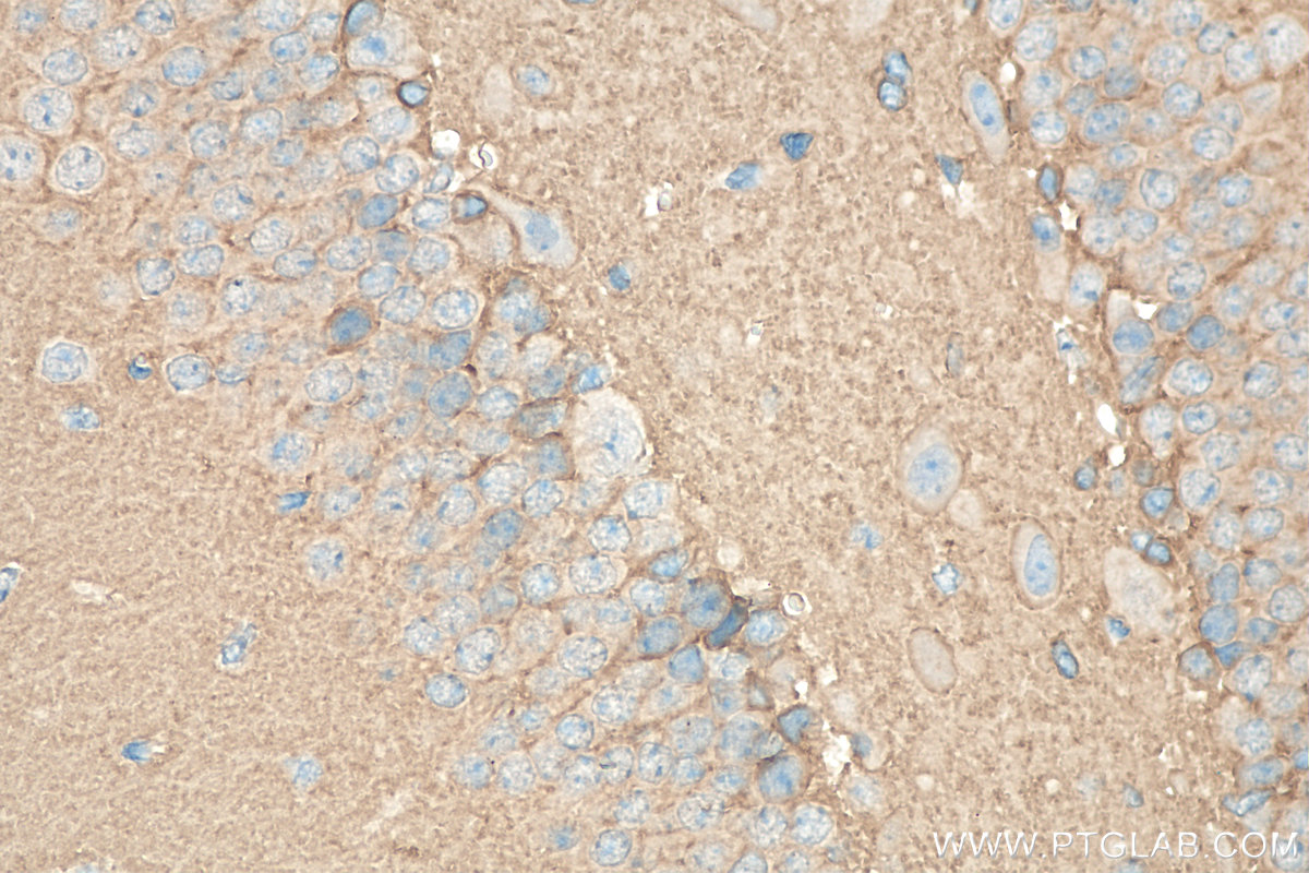 IHC staining of mouse brain using 30146-1-AP