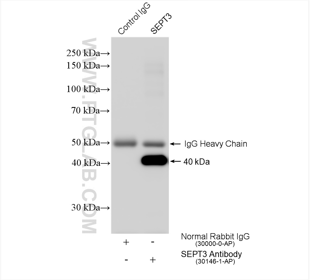 IP experiment of mouse brain using 30146-1-AP