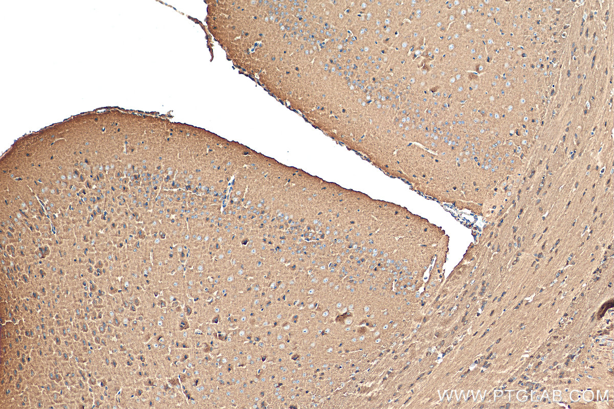 IHC staining of mouse brain using 12476-1-AP