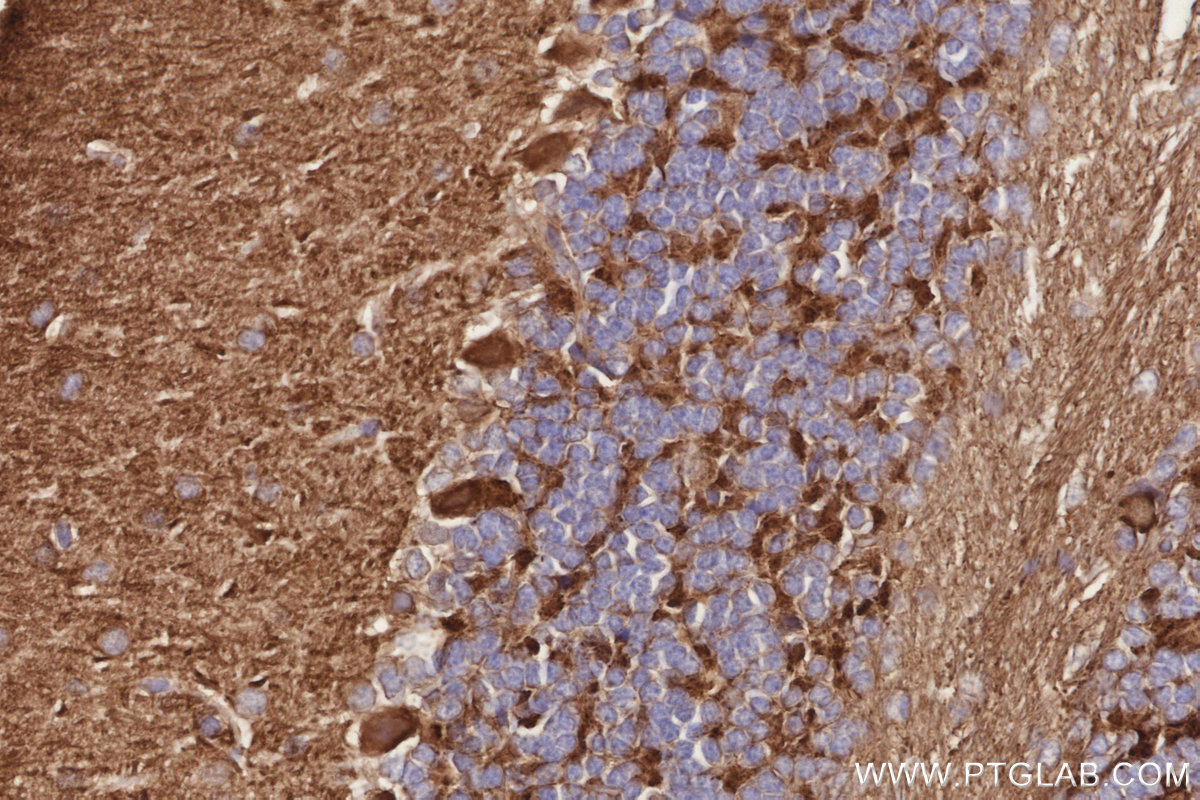IHC staining of mouse cerebellum using 11631-1-AP IHC staining of mouse cerebellum using 11631-1-AP