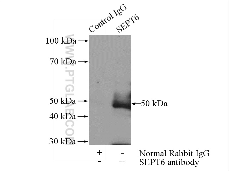 IP experiment of rat brain using 12805-1-AP (same clone as 12805-1-PBS)