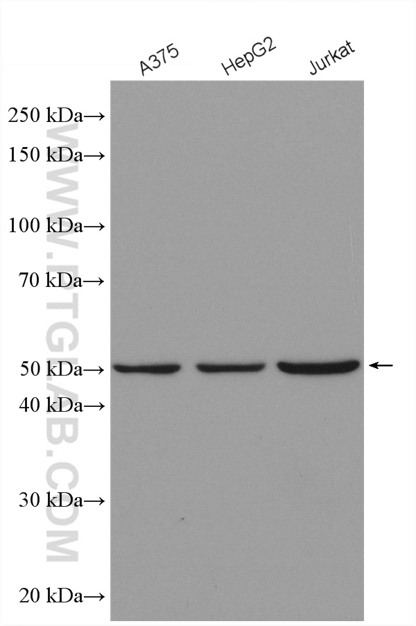 WB analysis using 13818-1-AP