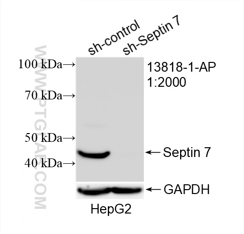 WB analysis of HepG2 using 13818-1-AP