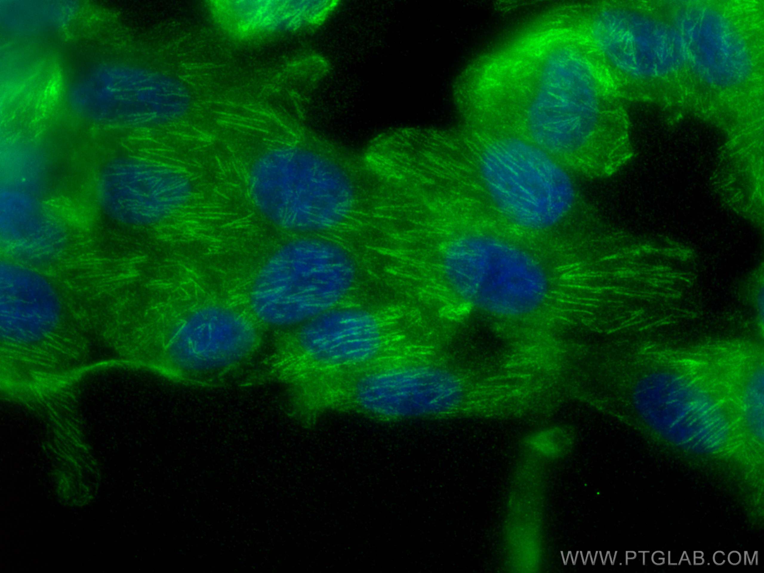 IF Staining of hTERT-RPE1 using 11769-1-AP