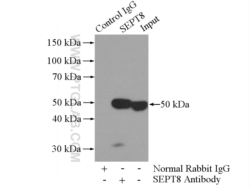 IP experiment of HeLa using 11769-1-AP