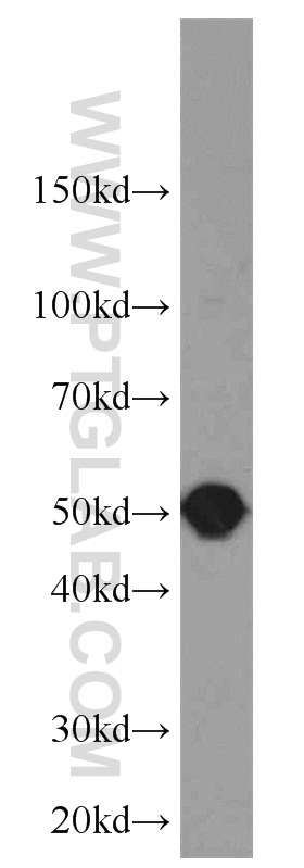 Septin 8 Polyclonal antibody