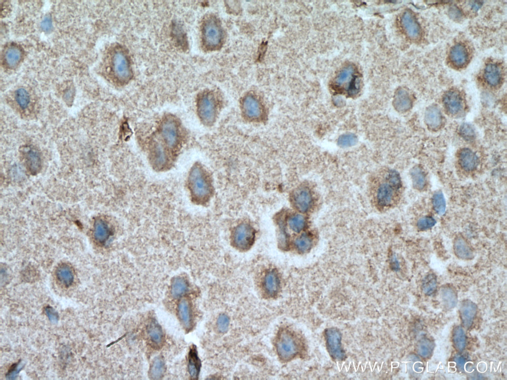 IHC staining of mouse brain using 66188-1-Ig