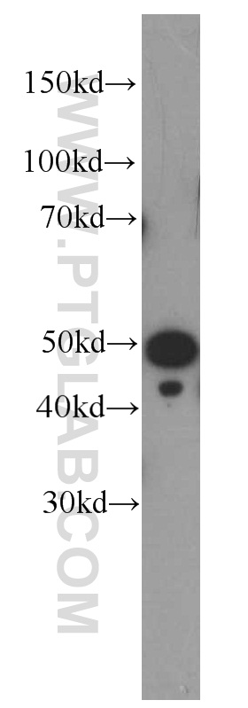 WB analysis of HeLa using 66188-1-Ig