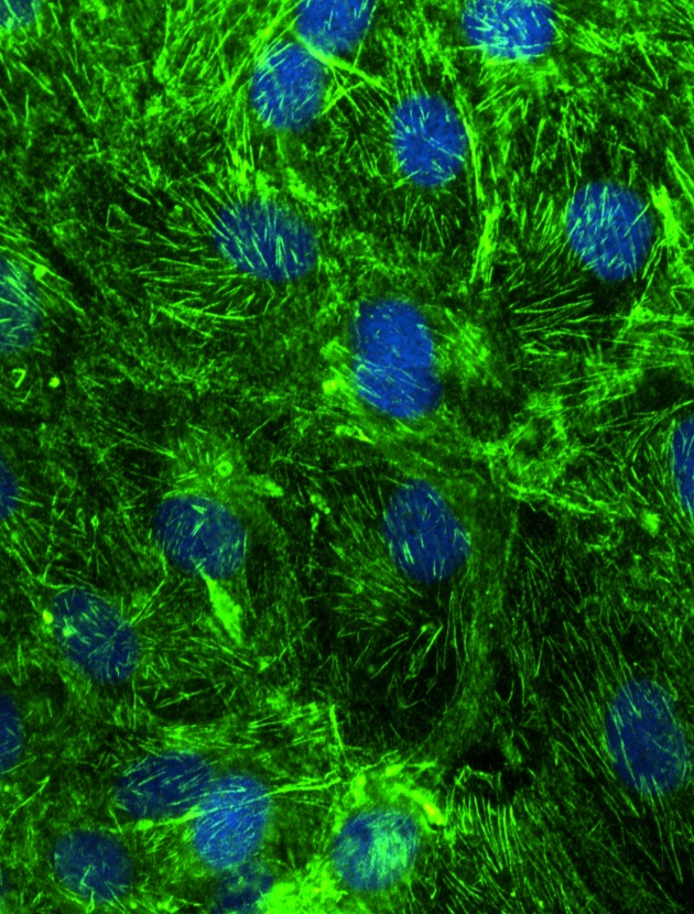 IF Staining of hTERT-RPE cells using 10769-1-AP