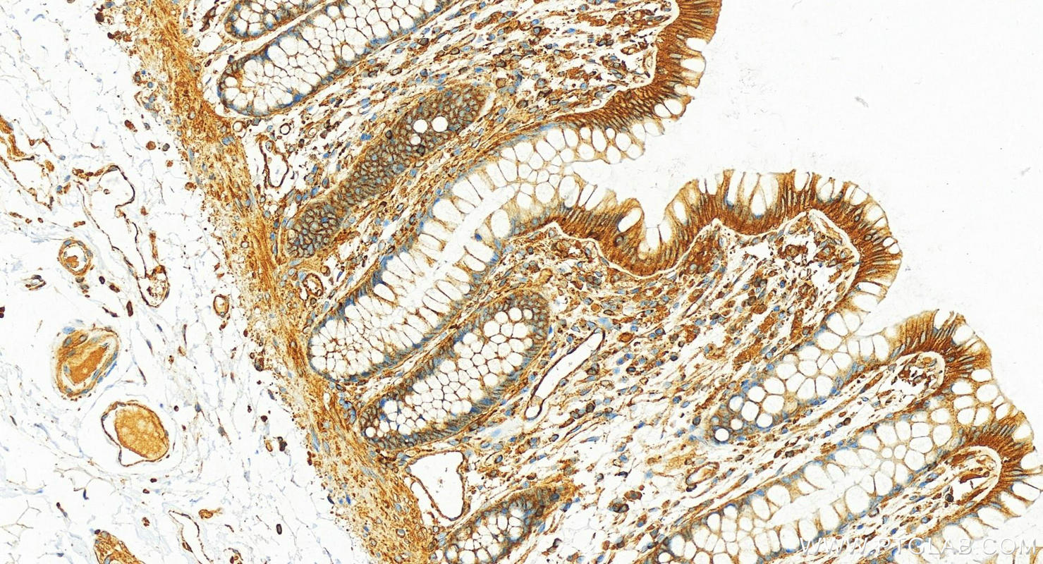 IHC staining of human colon using 82844-2-RR