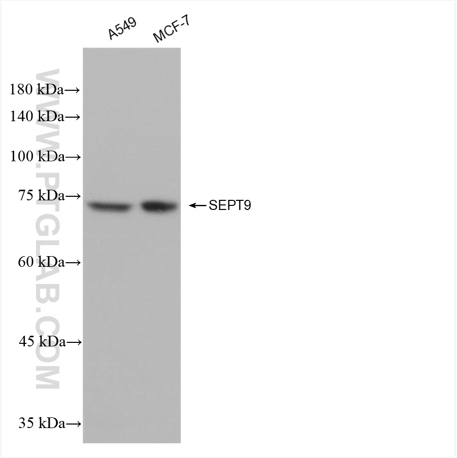 WB analysis using 82844-2-RR