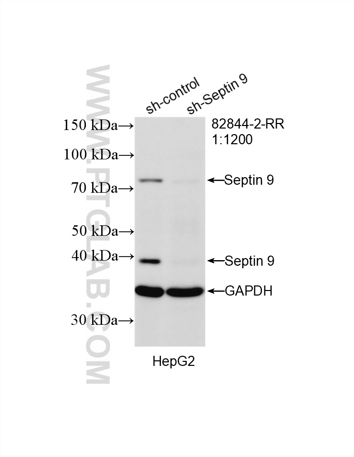 WB result of Septin 9 antibody (82844-2-RR; 1:1200; incubated at room temperature for 1.5 hours) with sh-Control and sh-Septin 9 transfected HepG2 cells. WB analysis of HepG2 using 82844-2-RR
