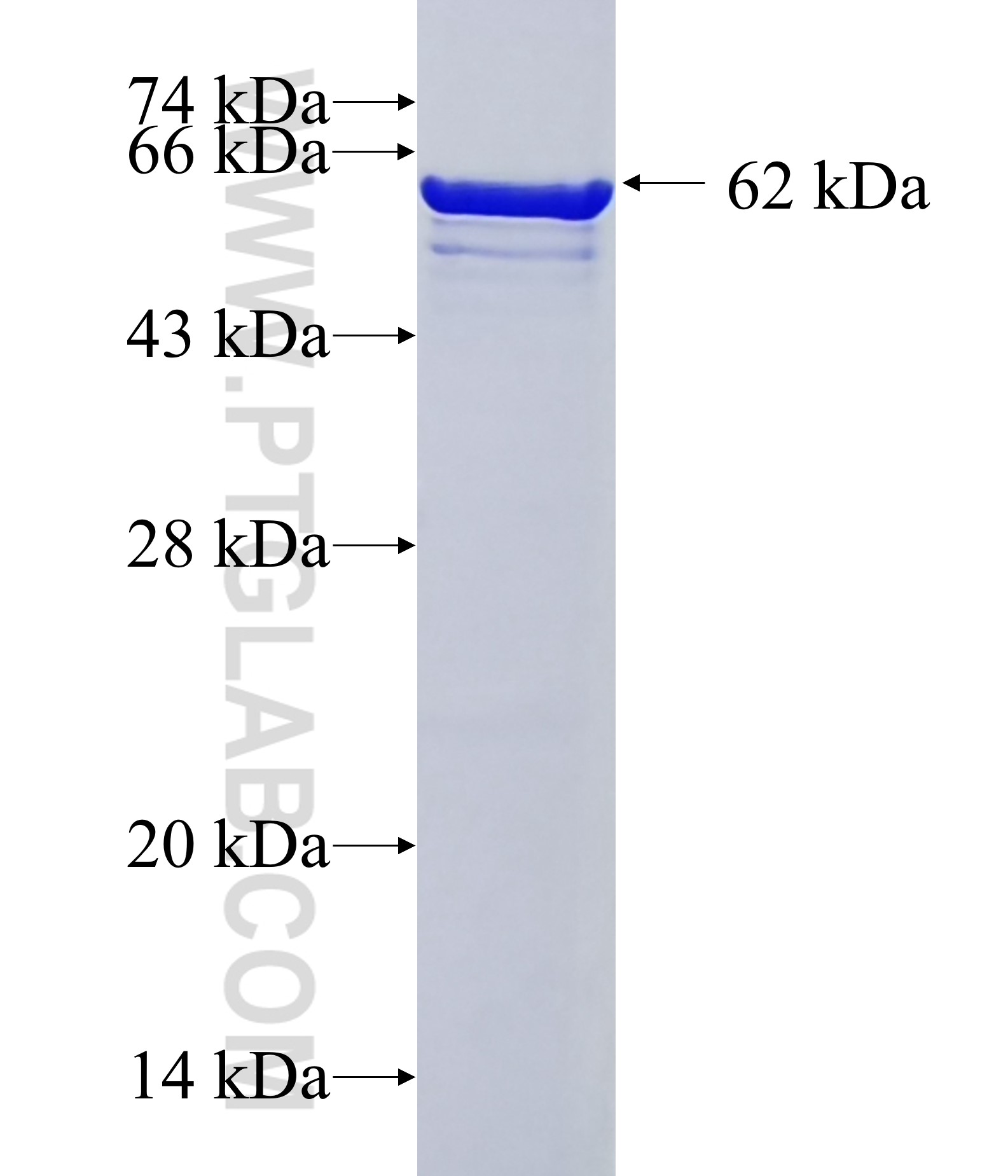 SEPT9 fusion protein Ag1218 SDS-PAGE