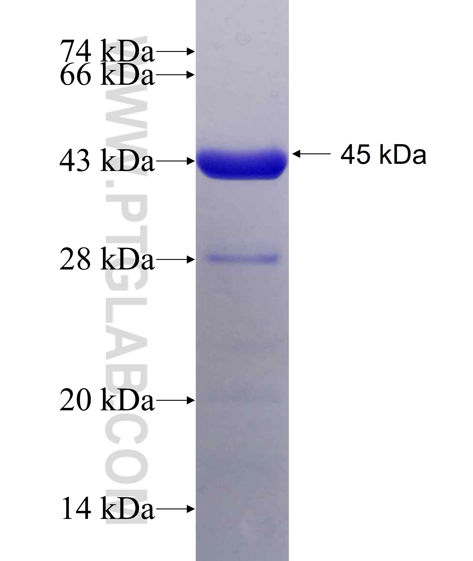 SEPT9 fusion protein Ag18047 SDS-PAGE