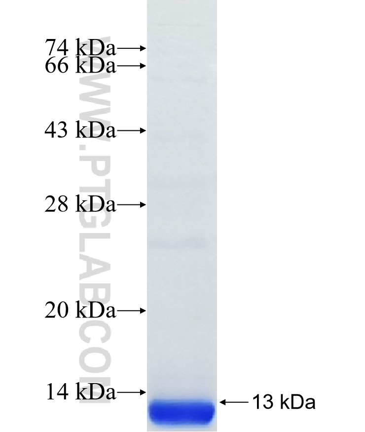 SEPW1 fusion protein Ag38385 SDS-PAGE SEPW1 fusion protein Ag38385 SDS-PAGE