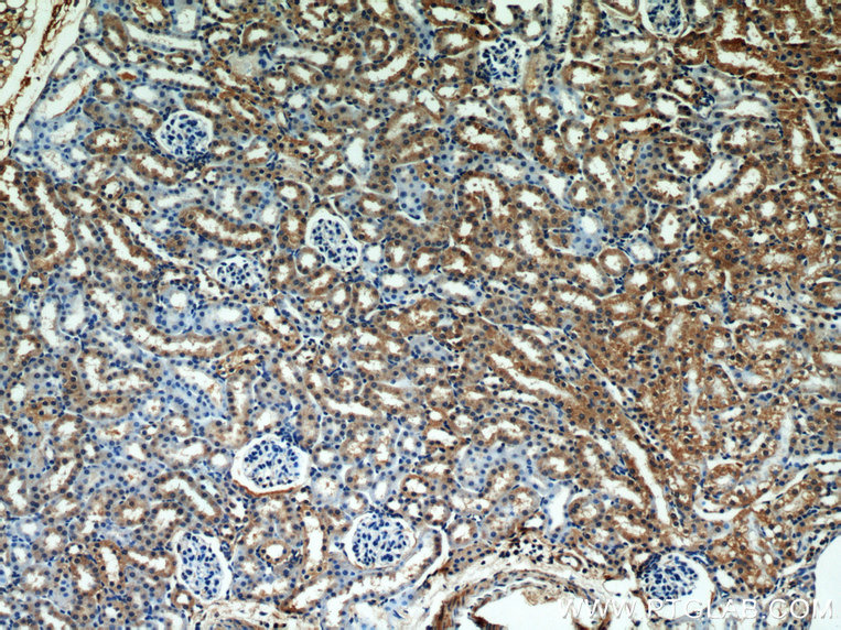 IHC staining of mouse kidney using 15333-1-AP