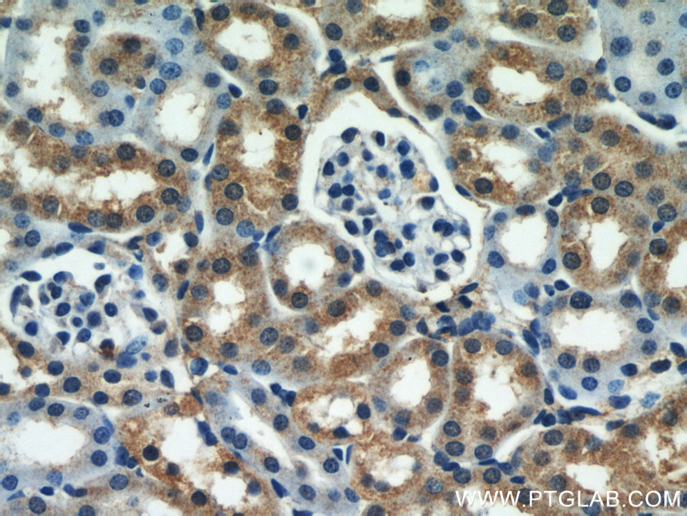 IHC staining of mouse kidney using 15333-1-AP