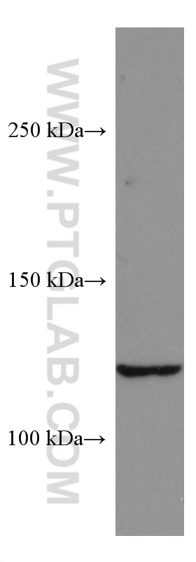 WB analysis of HEK-293 using 67248-1-Ig