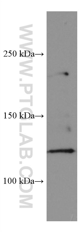 SERCA2,ATP2A2